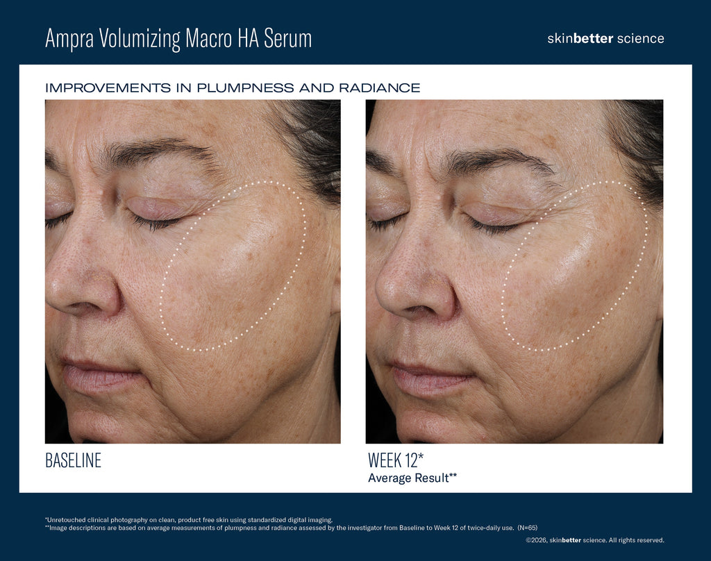Ampra Volumizing Macro HA Serum