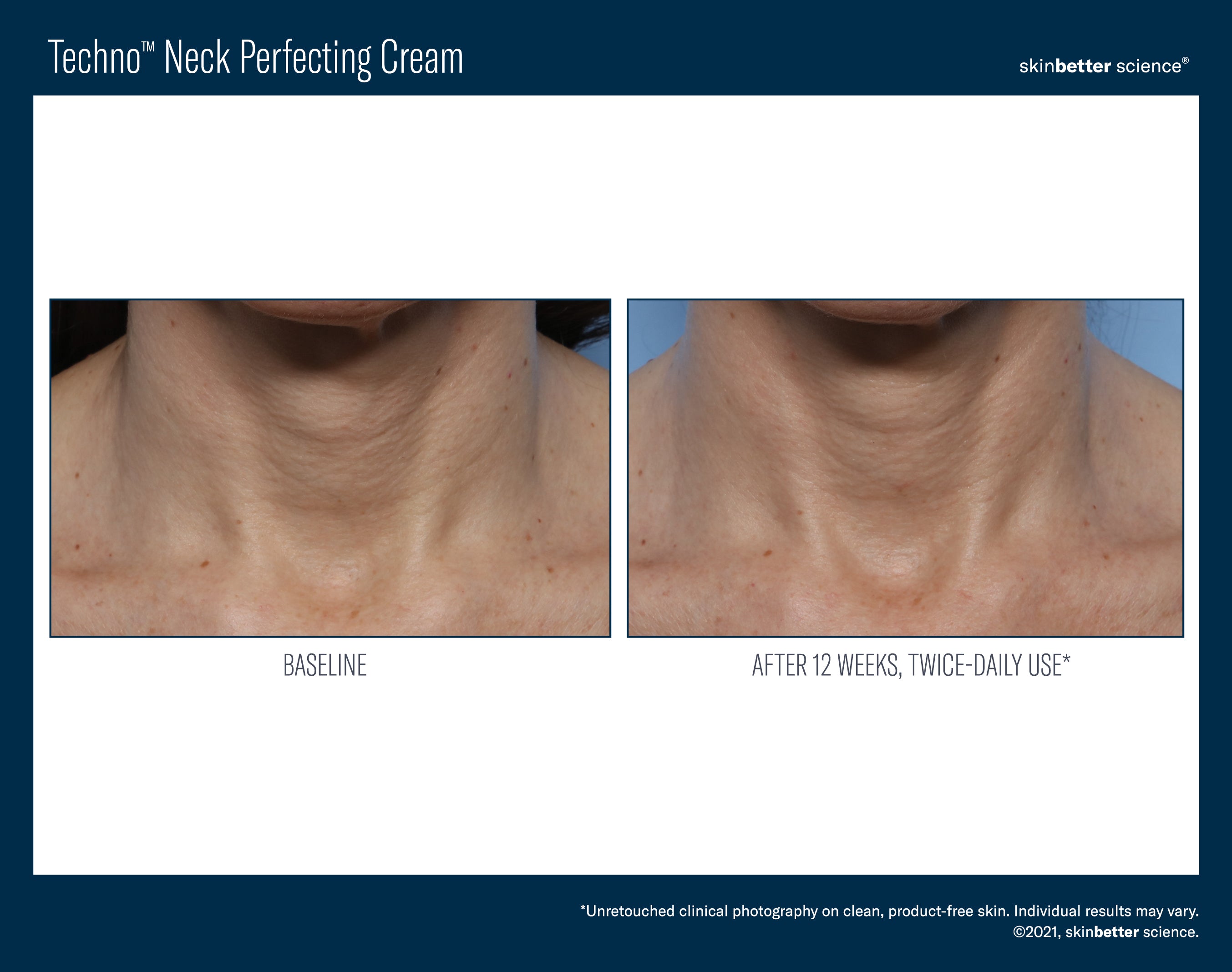 Skin Better Techno Neck Perfecting Cream
