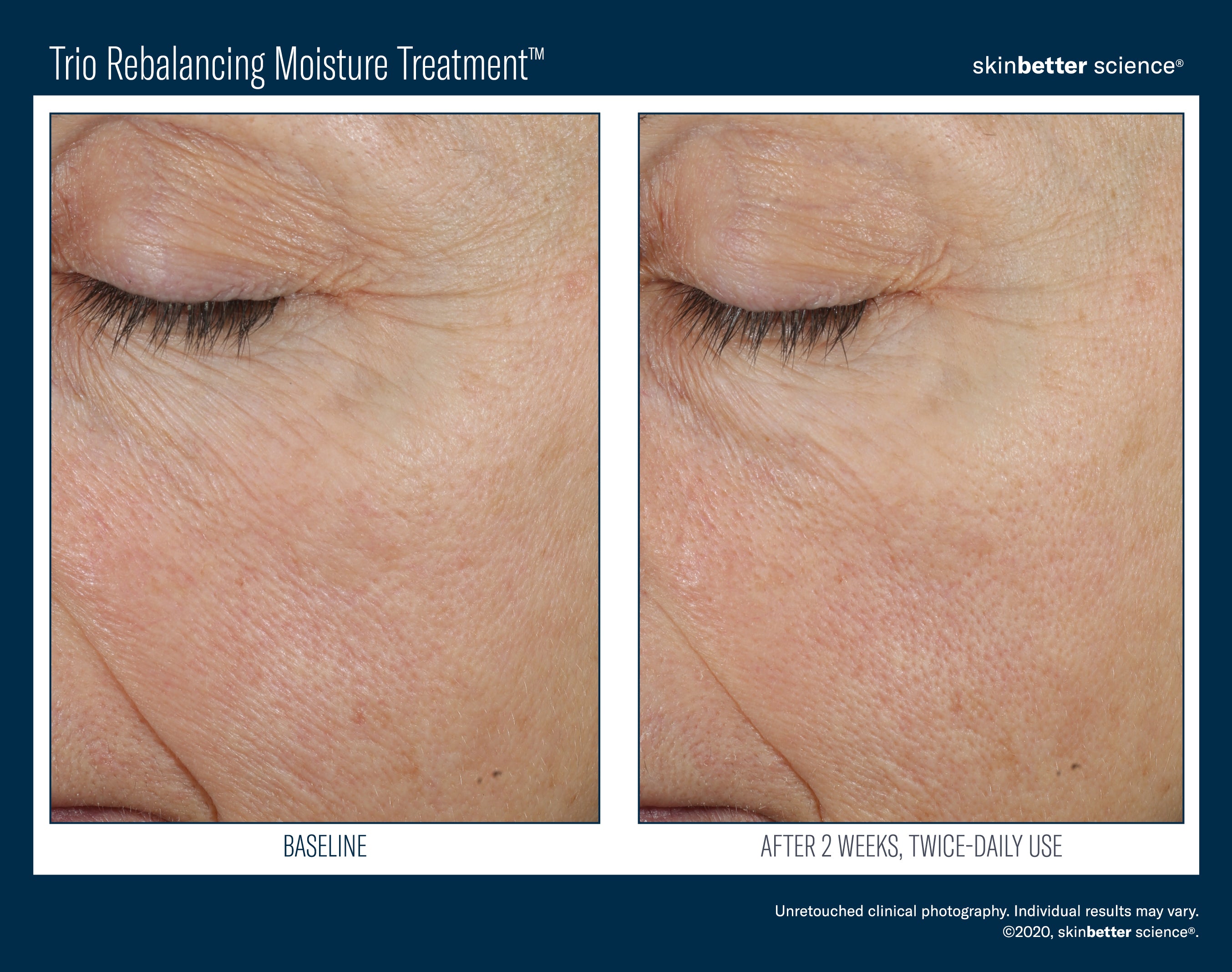 Skin Better Trio Rebalancing Moisture Treatment